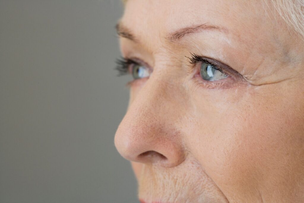 A close up of persons crow feet wrinkles near their eye